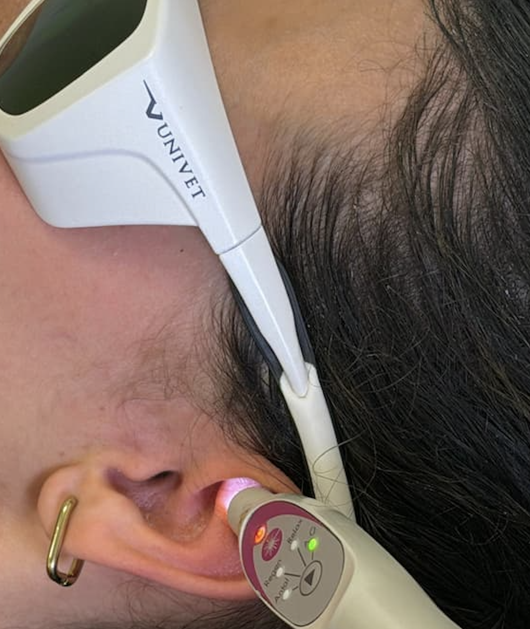 points d'auriculothérapie stimulés par le laser